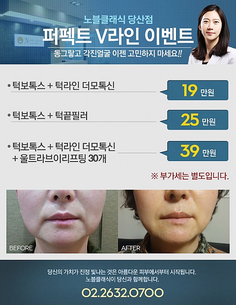 퍼펙트 V라인 이벤트 